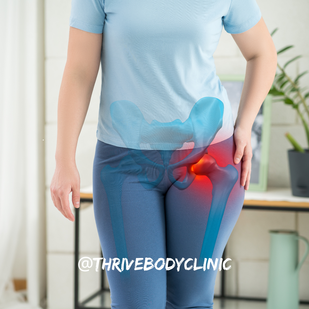 3 Essential Tips for Managing Hip Pain – Thrive Body Clinic Osteopathy ...